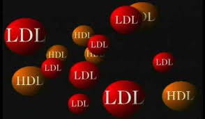 colesterol LDL - HDI