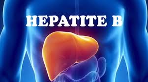 Hepatita B