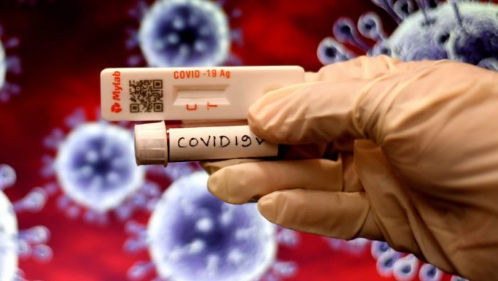 COVID 19 - TEST